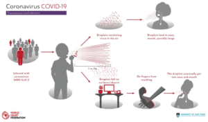 Infected with cpronavirus SARS-CoV-2